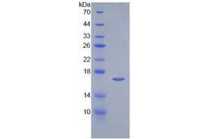 SDS-PAGE (SDS) image for Interleukin 2 (IL2) ELISA Kit (ABIN6574106)