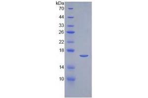 SDS-PAGE of Protein Standard from the Kit (Highly purified E. (IL-2 ELISA Kit)