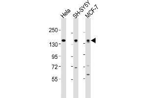 All lanes : Anti-ML2 Antibody (Center) at 1:2000 dilution Lane 1: Hela whole cell lysates Lane 2: SH-SY5Y whole cell lysates Lane 3: MCF-7 whole cell lysates Lysates/proteins at 20 μg per lane. (MAML2 antibody  (AA 780-814))