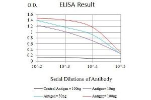 Black line: Control Antigen (100 ng),Purple line: Antigen (10 ng), Blue line: Antigen (50 ng), Red line:Antigen (100 ng) (CD7 antibody  (AA 26-180))