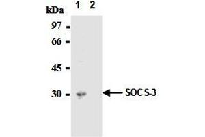 Immunoprecipitation of SOCS-3 from mouse hepatocytes with AM26562AF-N  or mouse IgG1  After immunoprecipitated with the antibody, immunocomplex was resolved on SDS-PAGE and immunoblotted with biotinylated anti-SOCS-3 monoclonal antibody. (SOCS3 antibody  (AA 2-44))