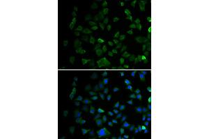 Immunofluorescence analysis of U2OS cell using MAP2K1 antibody. (MEK1 antibody)