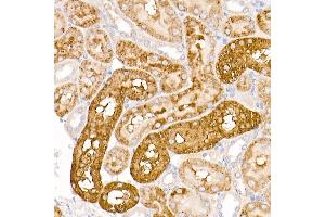 Immunohistochemistry of paraffin-embedded rat kidney using WRB Rabbit pAb (ABIN6129154, ABIN6150261, ABIN6150262 and ABIN6222768) at dilution of 1:250 (40x lens). (WRB antibody  (AA 30-100))