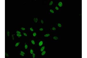 Immunofluorescent analysis of Hela cells using ABIN7152455 at dilution of 1:100 and Alexa Fluor 488-congugated AffiniPure Goat Anti-Rabbit IgG(H+L) (TBL1X antibody  (AA 1-300))