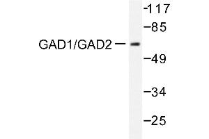 Image no. 2 for anti-Glutamate Decarboxylase 1 (Brain, 67kDa) (GAD1) antibody (ABIN271888) (GAD antibody)