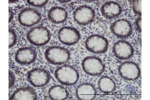 Immunoperoxidase of monoclonal antibody to SUPT5H on formalin-fixed paraffin-embedded human colon. (SUPT5H antibody  (AA 981-1087))