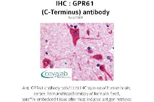 Image no. 1 for anti-G Protein-Coupled Receptor 61 (GPR61) (C-Term) antibody (ABIN1735133) (GPR61 antibody  (C-Term))