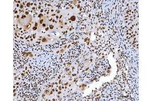 IHC analysis of C1orf77/FOP/CHTOP using anti-C1orf77/FOP/CHTOP antibody (ABIN7603201).