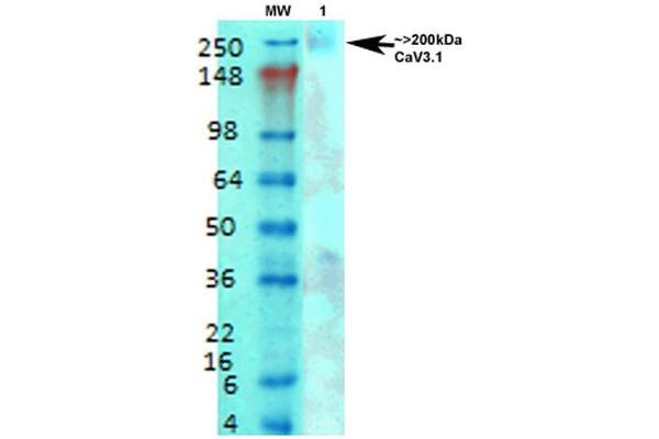 CACNA1G anticorps  (AA 2052-2172) (HRP)