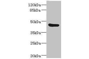 Western blot All lanes: BAAT antibody IgG at 3. (BAAT antibody  (AA 309-418))