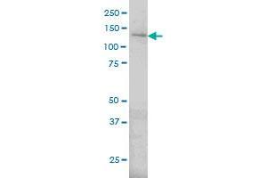 ERN1 antibody  (AA 401-500)