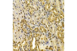 Immunohistochemistry of paraffin-embedded rat kidney using PIN1 antibody at dilution of 1:100 (x400 lens). (PIN1 antibody)