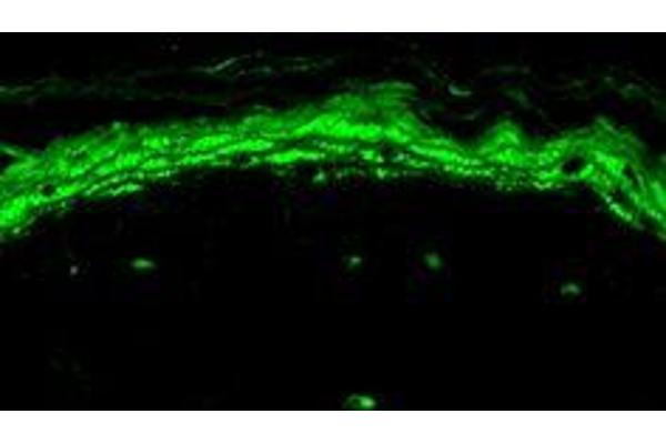 Nav1.8 antibody  (AA 1724-1956) (HRP)