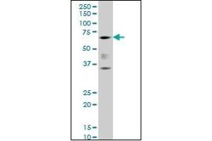 Western Blotting (WB) image for anti-Runt-Related Transcription Factor 2 (RUNX2) (AA 251-351) antibody (ABIN614586) (RUNX2 antibody  (AA 251-351))