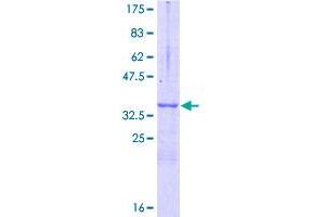 Nerve Growth Factor Receptor (TNFRSF16) Associated Protein 1 (NGFRAP1) (AA 1-101) protein (GST tag)