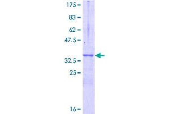 Nerve Growth Factor Receptor (TNFRSF16) Associated Protein 1 (NGFRAP1) (AA 1-101) protein (GST tag)
