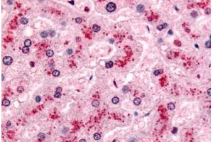 Human Liver (formalin-fixed, paraffin-embedded) stained with PYGL antibody ABIN213380 at 10 ug/ml followed by biotinylated goat anti-rabbit IgG secondary antibody ABIN481713, alkaline phosphatase-streptavidin and chromogen. (PYGL antibody  (Internal Region))