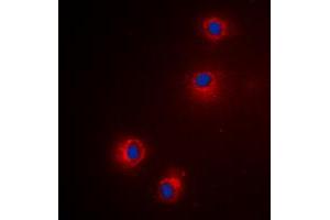 Immunofluorescent analysis of Granzyme H staining in Hela cells. (GZMH antibody  (Center))
