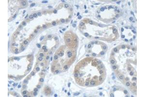 DAB staining on IHC-P; Samples: Human Kidney Tissue (IARS antibody  (AA 1-500))
