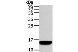 Western Blot analysis of Human normal prostate tissue using VAMP5 Polyclonal Antibody at dilution of 1/650 (VAMP5 antibody)