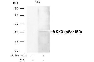 Western blot analysis of extracts from 3T3 cells, treated with Anisomycin or calf intestinal phosphatase (CIP), using MKK3 (Phospho-Ser189) Antibody. (MAP2K3 antibody  (pSer189))