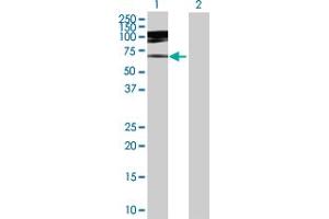 Western Blot analysis of IQWD1 expression in transfected 293T cell line by IQWD1 MaxPab polyclonal antibody. (DCAF6 antibody  (AA 1-513))