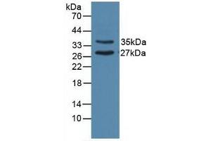 Detection of UNG in Porcine Heart Tissue using Polyclonal Antibody to Uracil DNA Glycosylase (UNG) (UNG antibody  (AA 1-313))