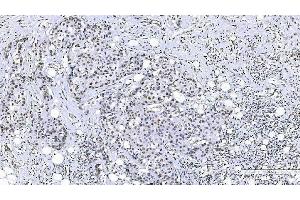 IHC analysis of FOXK1 using anti-FOXK1 antibody (ABIN7600295). (Foxk1 antibody  (AA 175-671))