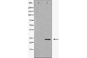 PLGF antibody  (Internal Region)