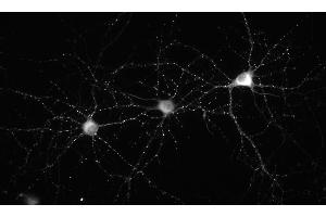 Immunofluorescence staining of 14 DIV cultured rat hippocampal neurons.