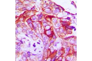 Immunohistochemistry (IHC) image for anti-Ret Proto-Oncogene (RET) (C-Term), (pTyr1062) antibody (ABIN7301218)