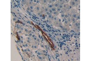 Used in DAB staining on fromalin fixed paraffin- embedded Kidney tissue (HCK antibody  (AA 2-526))