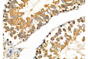 anti-Synuclein, gamma (Breast Cancer-Specific Protein 1) (SNCG) (C-Term) antibody