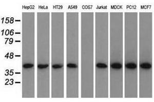 Image no. 2 for anti-Acetyl-CoA Acetyltransferase 2 (ACAT2) antibody (ABIN1496398) (ACAT2 antibody)