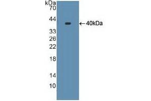 Detection of Recombinant S17aH, Human using Polyclonal Antibody to Cytochrome P450 17A1 (CYP17A1) (CYP17A1 antibody  (AA 183-508))
