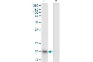 NDUFAB1 antibody  (AA 1-156)