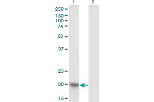 NDUFAB1 antibody  (AA 1-156)