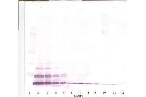 Image no. 1 for anti-Chemokine (C-C Motif) Ligand 26 (CCL26) antibody (ABIN465091) (CCL26 antibody)