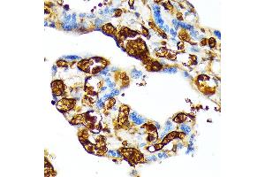 Immunohistochemistry of paraffin-embedded human placenta using HBG1 Rabbit mAb (ABIN1679149, ABIN1679148, ABIN7101336 and ABIN7101337) at dilution of 1:100 (40x lens). (HBG1/2 antibody)