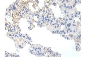Immunohistochemistry (IHC) image for anti-phosphofructokinase, Muscle (PFKM) (AA 2-390) antibody (ABIN7435508)
