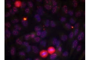 Immunofluorescence staining of methanol-fixed HeLa cells using Elk-1 (phospho-Thr417) antibody (E011038, Red) (ELK1 antibody  (pThr417))