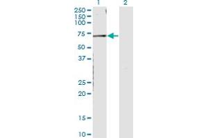 Western Blot analysis of CNKSR3 expression in transfected 293T cell line by CNKSR3 monoclonal antibody (M01), clone 4A11. (CNKSR3 antibody  (AA 366-464))