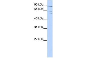WB Suggested Anti-XPNPEP2 Antibody Titration:  0. (XPNPEP2 antibody  (Middle Region))