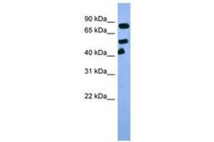 Image no. 1 for anti-Aryl Hydrocarbon Receptor Nuclear Translocator (ARNT) (C-Term) antibody (ABIN6746022) (ARNT antibody  (C-Term))