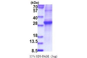 SDS-PAGE (SDS) image for Kallikrein 11 (KLK11) (AA 54-278) protein (ABIN5853826) (Kallikrein 11 Protein (KLK11) (AA 54-278))