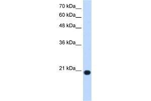 WB Suggested Anti-UXT Antibody Titration:  1. (UXT antibody  (N-Term))