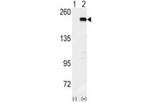 Western blot analysis of GCN2 antibody and 293 cell lysate (2 ug/lane) either nontransfected (Lane 1) or transiently transfected with the GCN2 gene (2).