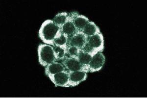 Immunofluorescent staining of WIDR cells. (Dynamitin antibody  (AA 55-196))