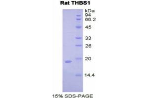 SDS-PAGE (SDS) image for Thrombospondin 1 (THBS1) (AA 327-478) protein (His tag) (ABIN2122200)