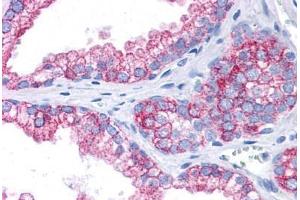 Human Prostate: Formalin-Fixed, Paraffin-Embedded (FFPE) (EPB41L2 antibody  (AA 481-530))